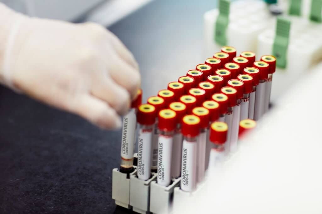  Close-up of scientist is examining medical sample