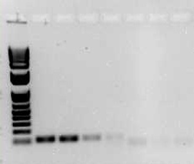 DNA的琼脂糖凝胶的照片.png