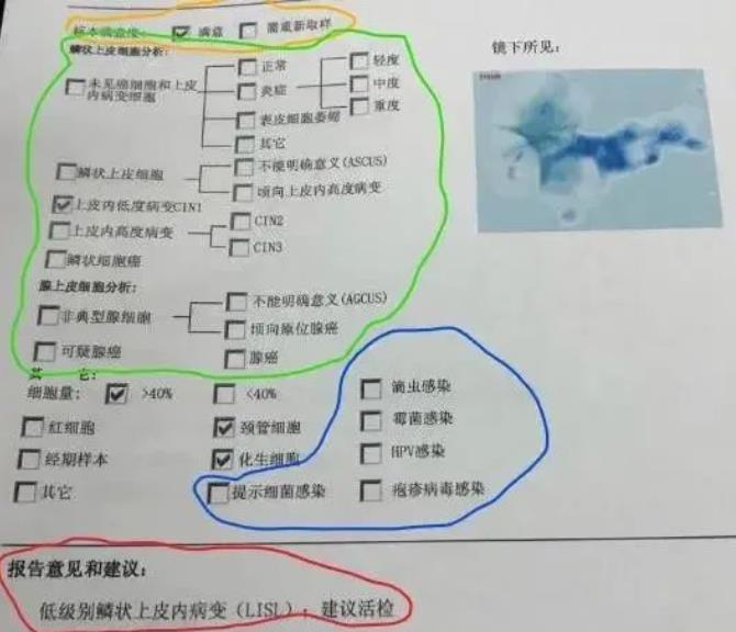 TCT检测报告单