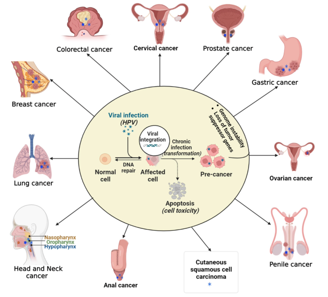HPV驱动的不同癌症