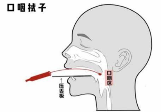 口咽拭子采集示意图