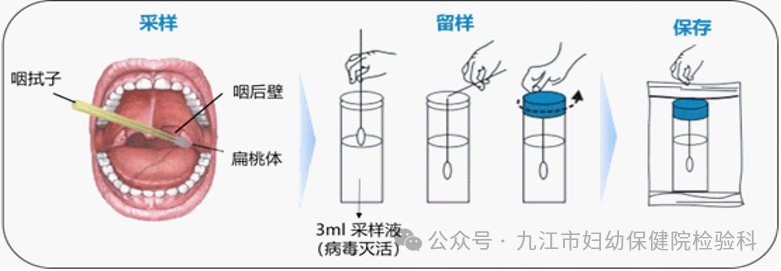 呼吸道标本的采集和送检.png